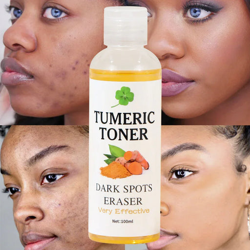 Tumeric toner bottle with a woman's face showing dark spots above and below it.